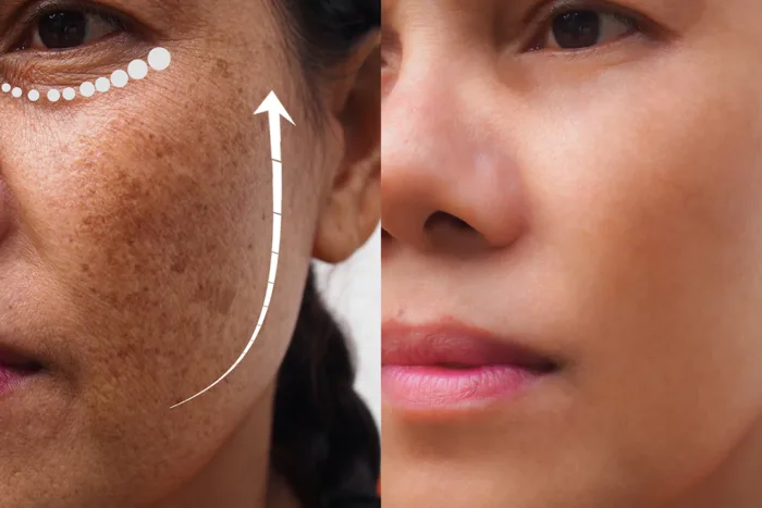Revitol Skin Brightener Cream - Image 2